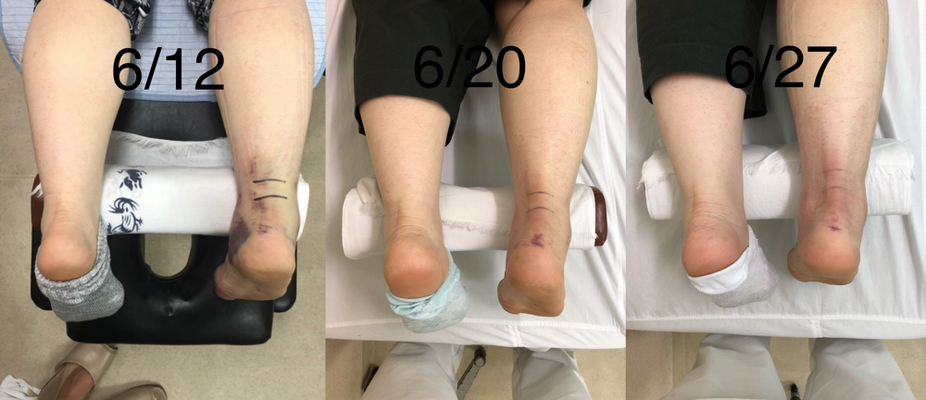 ギャラリー ギャラリー