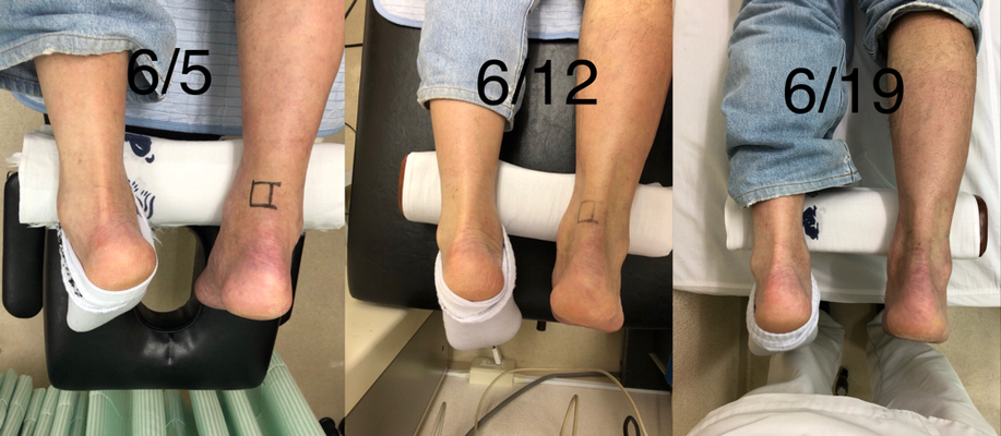 ギャラリー ギャラリー